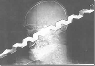 drill in head